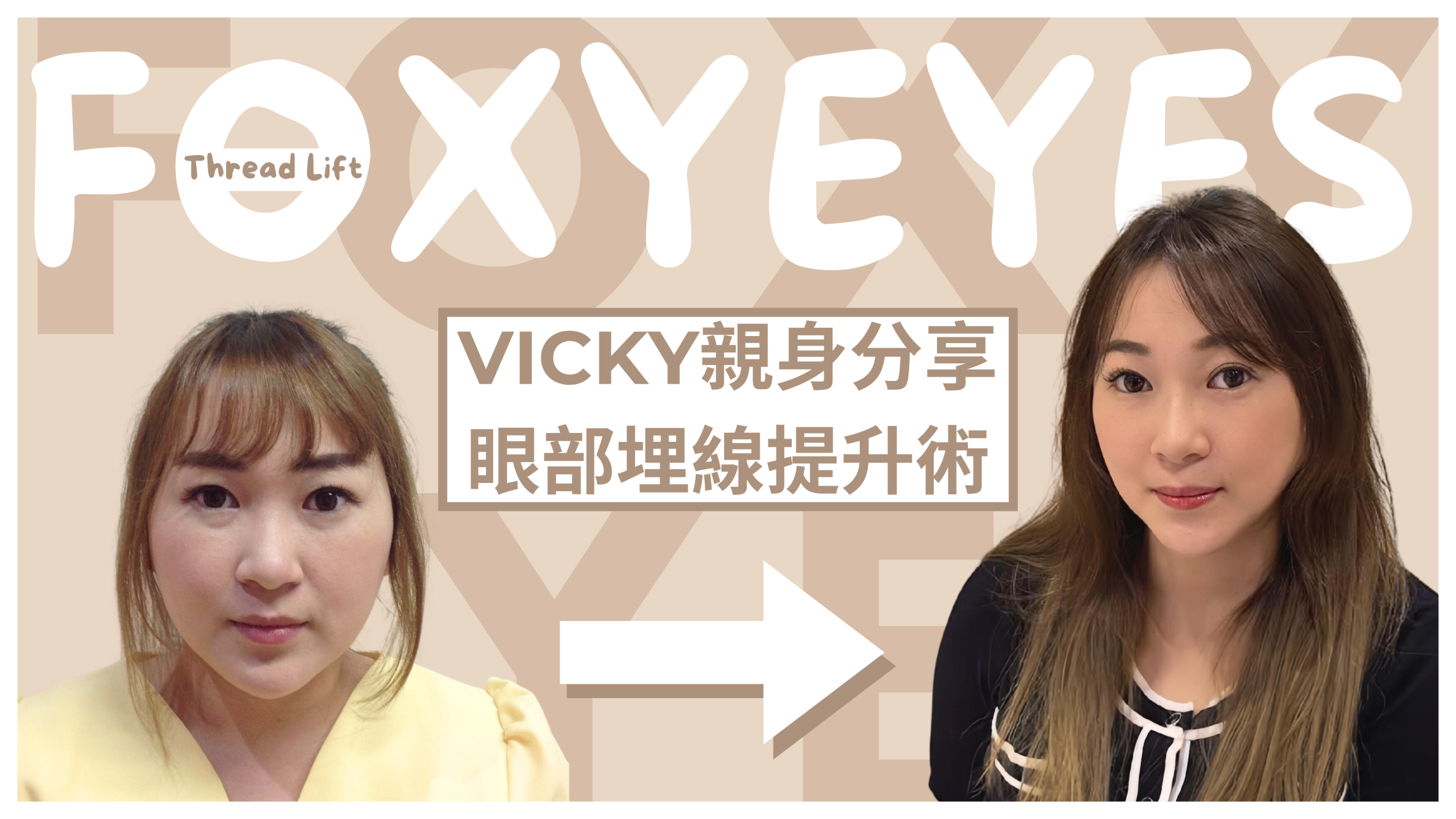 V Beauty Before &amp; After (1)