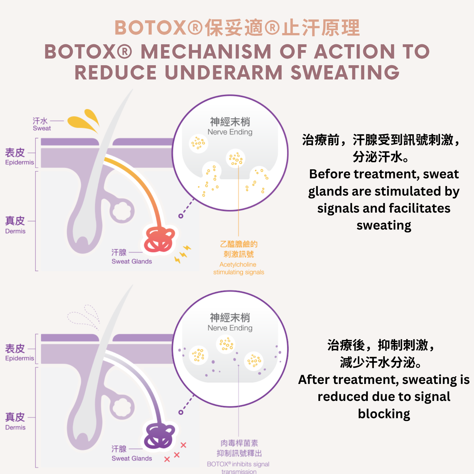 本頁圖片/檔案 - BOTOX®保妥適®止汗原理