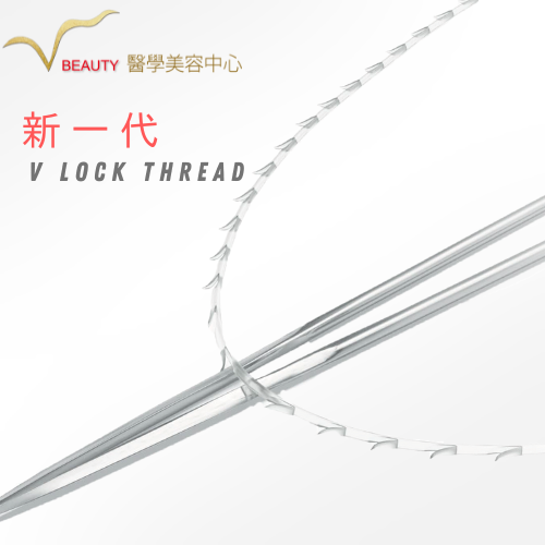 V lock thread