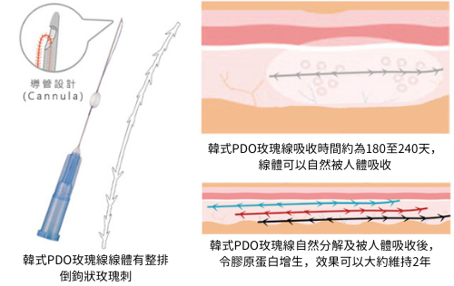 本頁圖片/檔案 - Barbed Thread - Chinese
